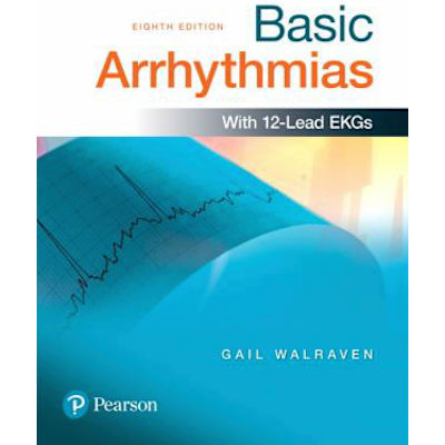 Basic Arrhythmias